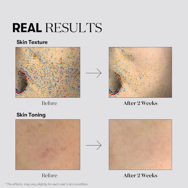 Balinošs krēms ar traneksāmskābi VT Cosmetics TX-Toning Cream