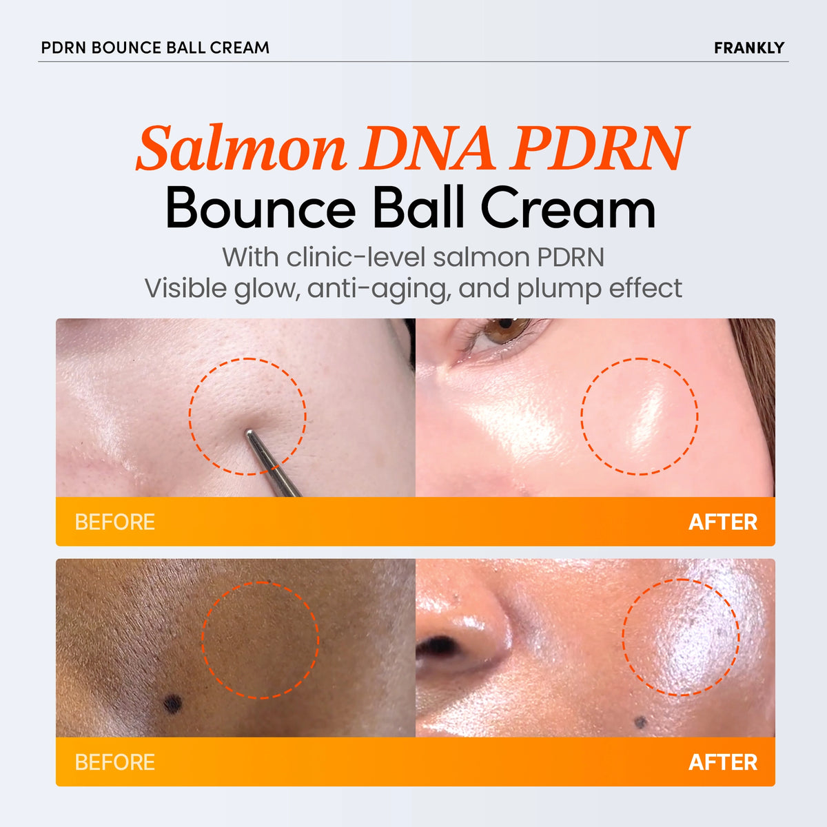 Гель-крем с PDRN FRANKLY PDRN Bounce Ball Cream